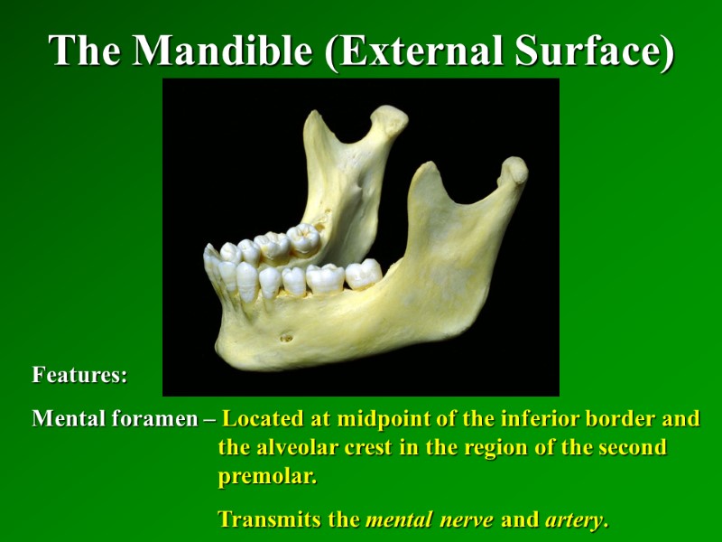 The Mandible (External Surface)   Features: Mental foramen – Located at midpoint of